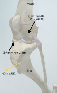 膝関節